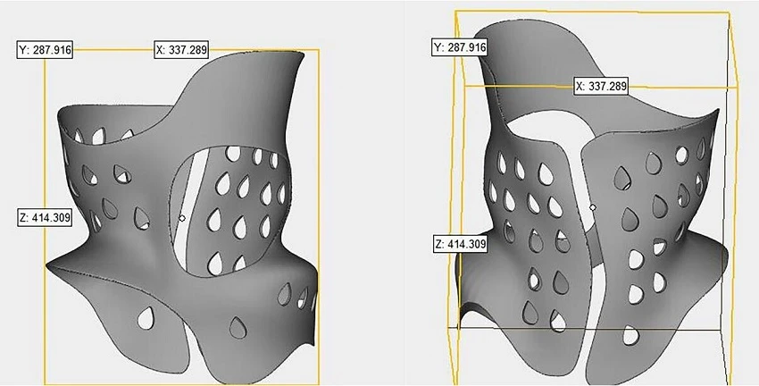 design of 3D printing scoliosis braces